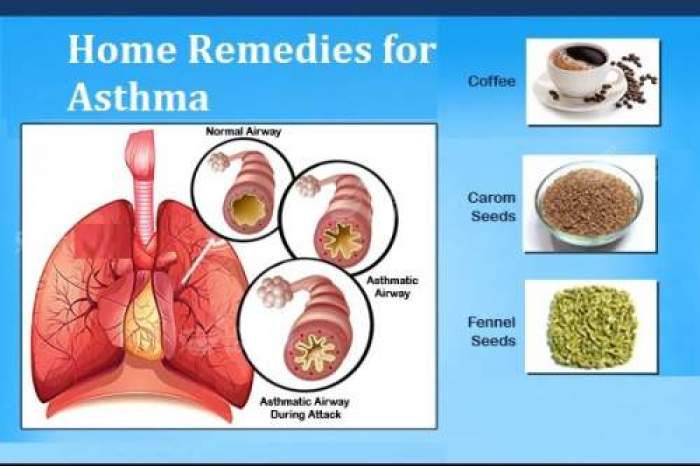Top 4 Natural Home Remedies for Asthma