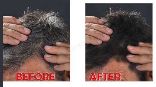 Facts About Premature Grey Hair