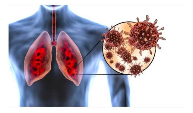 benefits of Ayurveda in protecting the body and lungs from the coronavirus