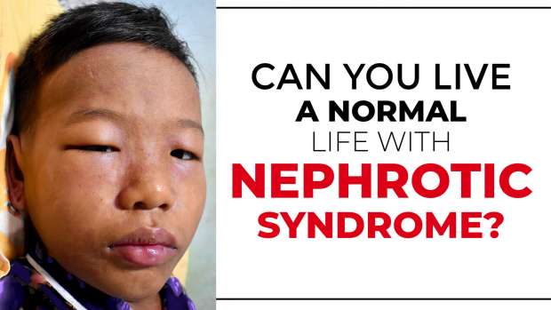 Nephrotic syndrome symptoms