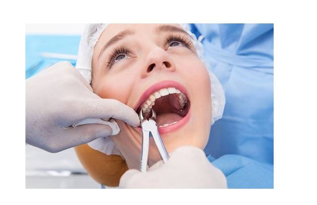 wisdom teeth removal women