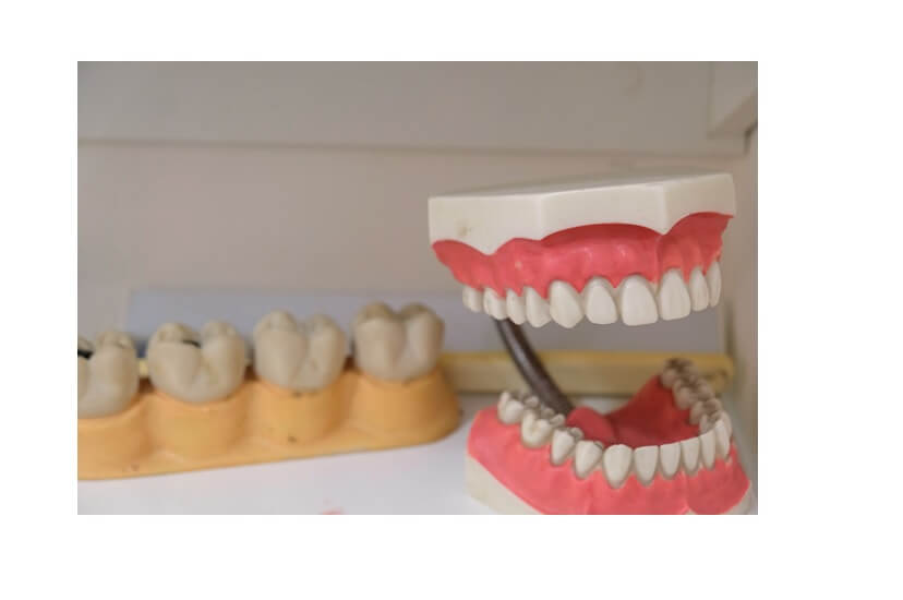 Dentures: Types, Alternatives, Cost & More
